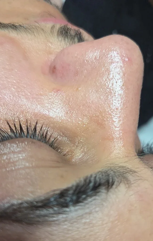 Haut nach der Gesichtsreinigung — klareres Hautbild bei Lady Vi