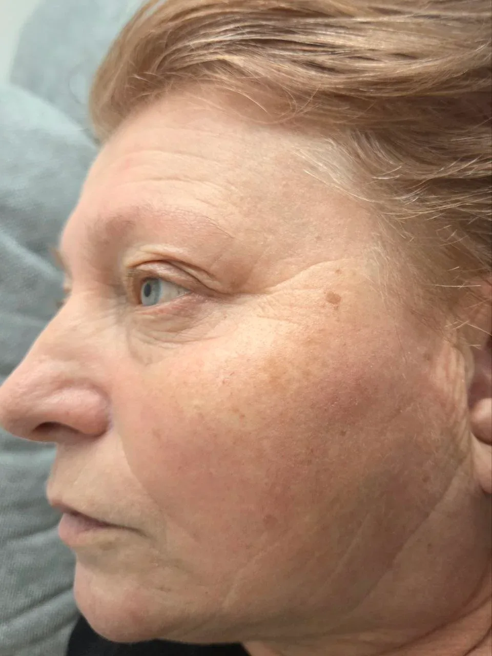 Anti-Aging Behandlung — Praxisfoto 6, Praxis Lady Vi Kosmetikstudio Bad Ems