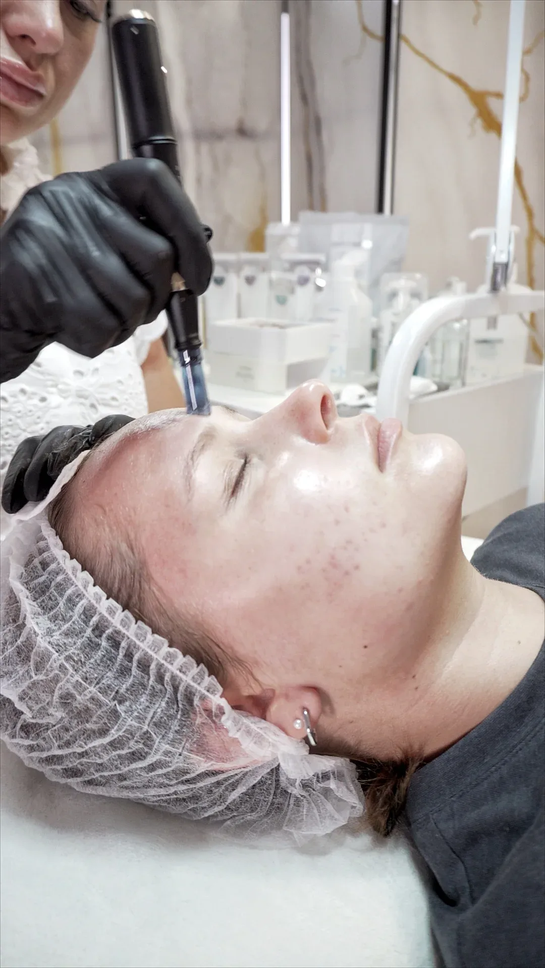 Microneedling — Praxisfoto 1, Praxis Lady Vi Kosmetikstudio Bad Ems
