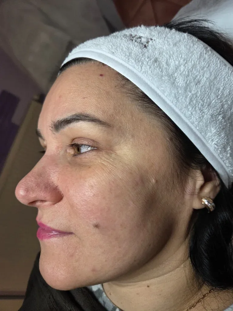 Chemisches Peeling — Praxisfoto 4, Praxis Lady Vi Kosmetikstudio Bad Ems