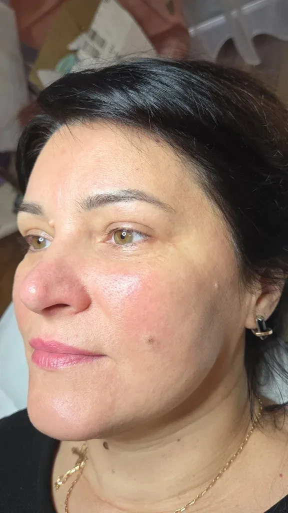 Chemisches Peeling — Praxisfoto 6, Praxis Lady Vi Kosmetikstudio Bad Ems